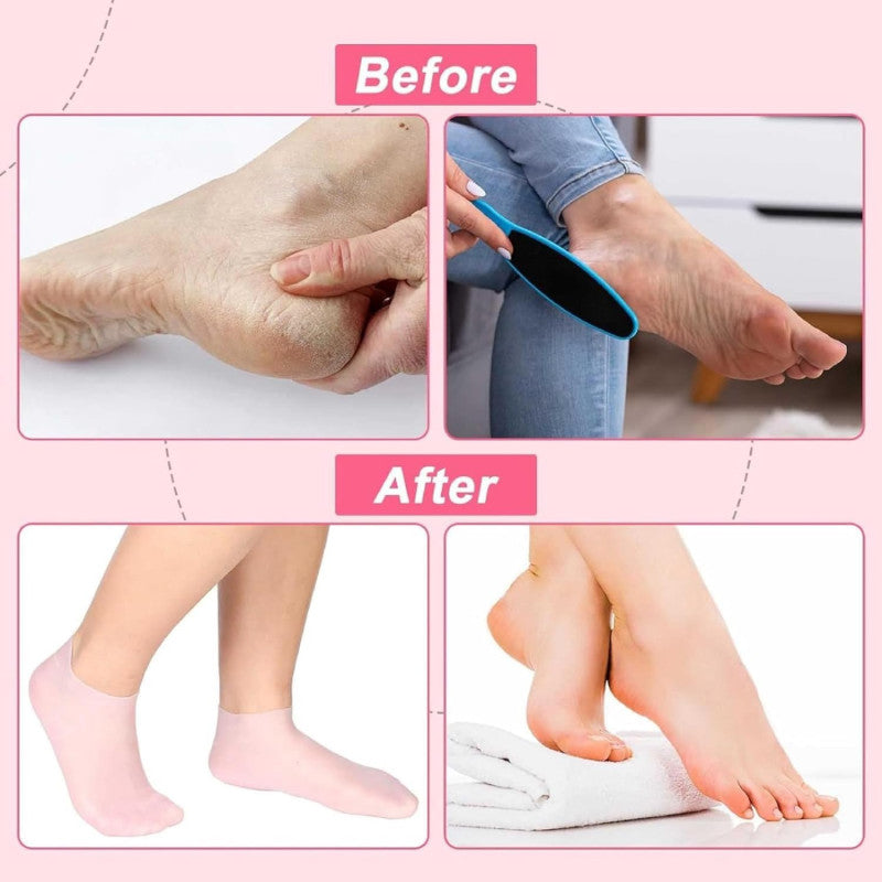 Silicone Moisturizing Gel Socks